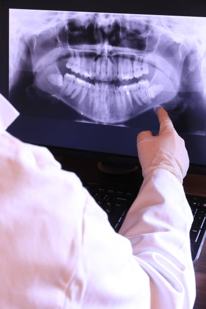 Best Urgent Dental Care for Toothaches in University Of Lifornia Santa Barbara, CA