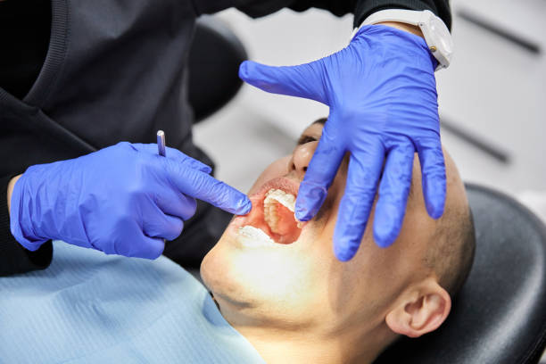 Best Dental Abscess Treatment in University Of Lifornia Santa Barbara, CA