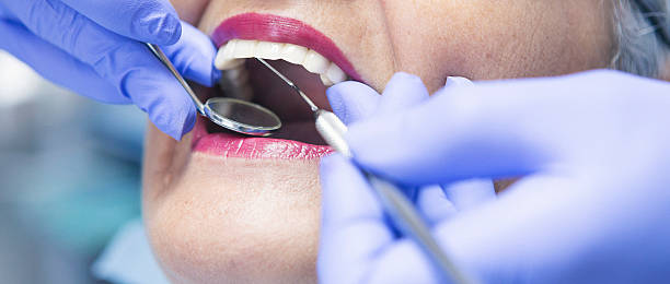 Best Emergency Care for Gum Disease in University Of Lifornia Santa Barbara, CA